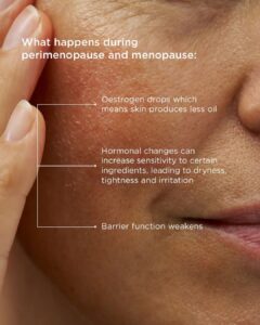 Perimenopause Skin Symptoms